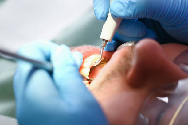 Best After-Hours Emergency Dentist in Milam, TX